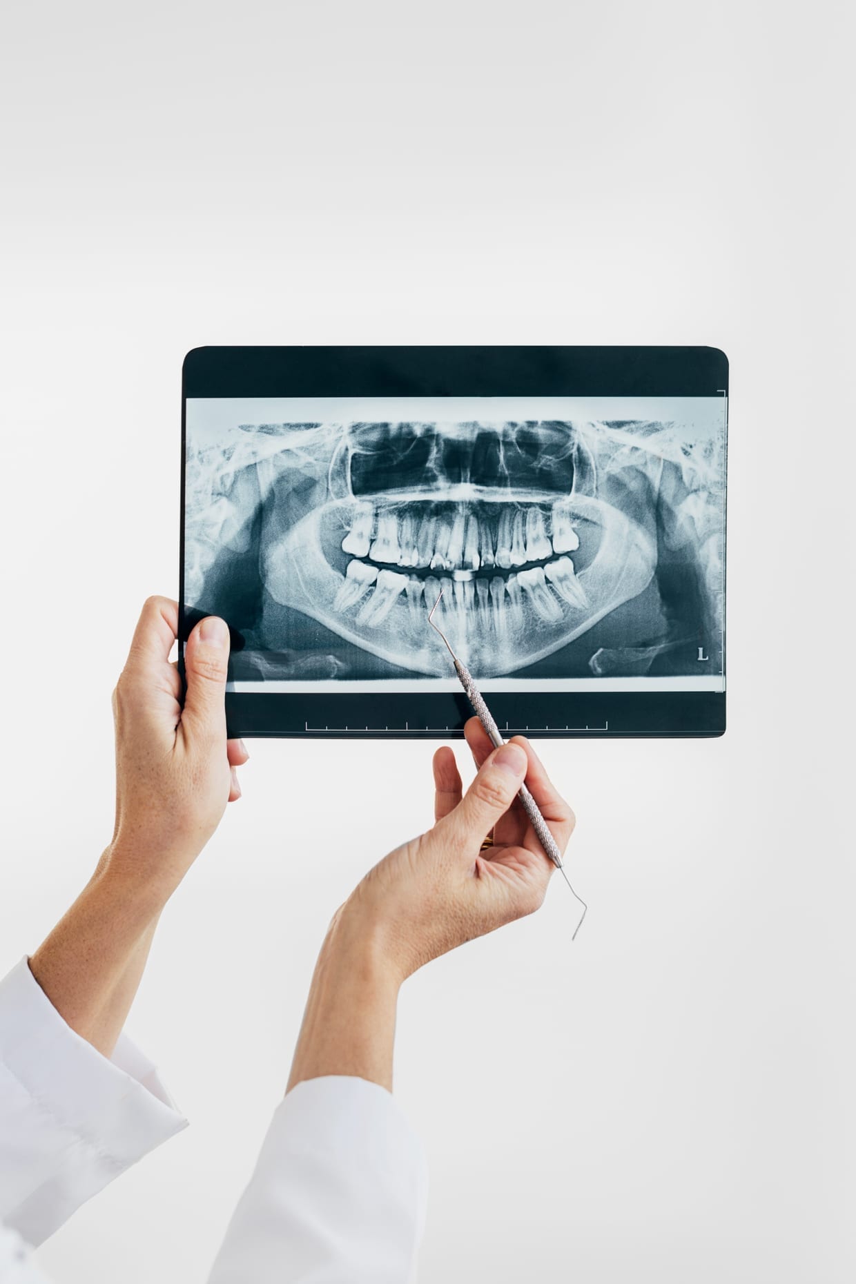 Dentist showing an x-ray scan of someone's teeth.